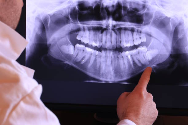 Best Emergency Root Canal Treatment in Shorewood, IL