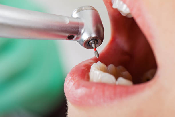 Best Holiday Emergency Dentist in Shorewood, IL
